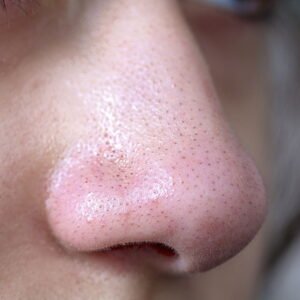 Facial Pureza Profunda